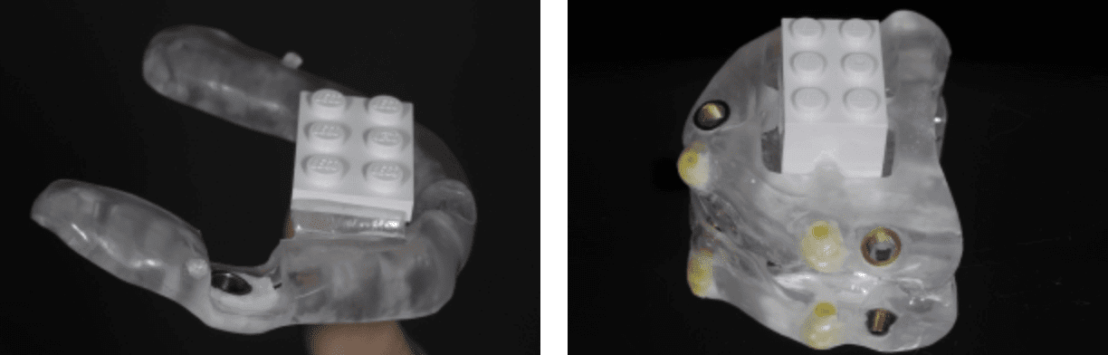 誤差0.002mm以内のレゴシステムを用いたサージカルガイドの製作